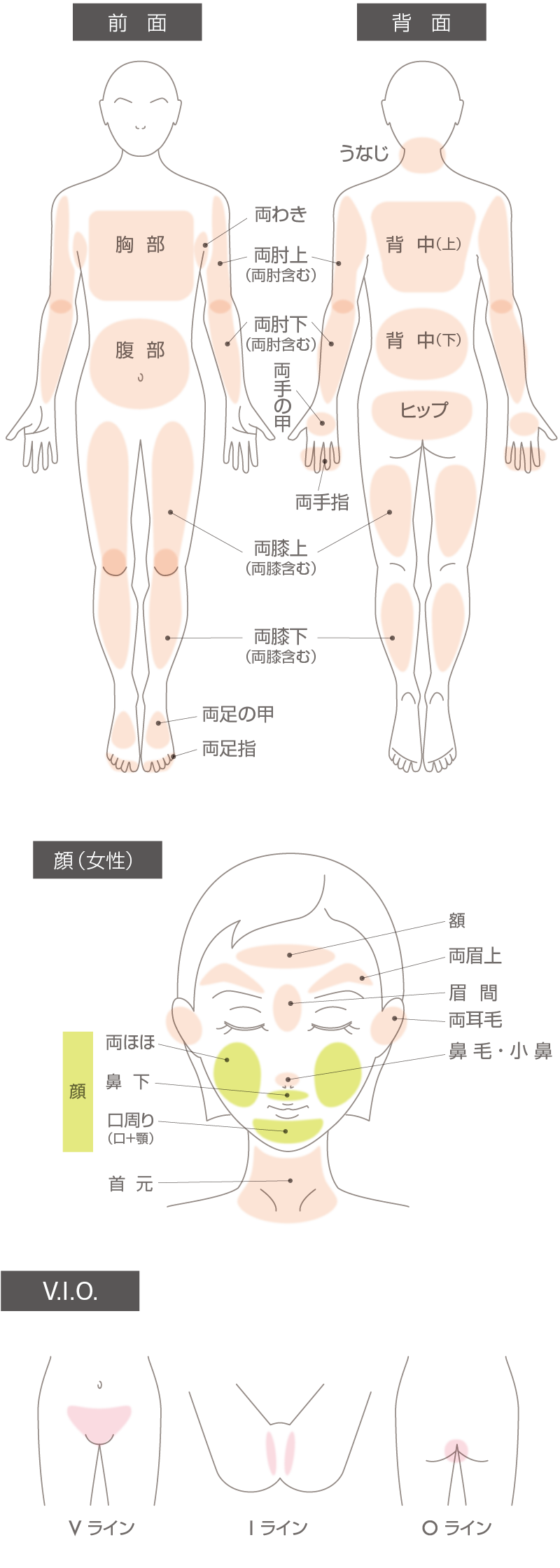 女性脱毛エリア表 スマホ用