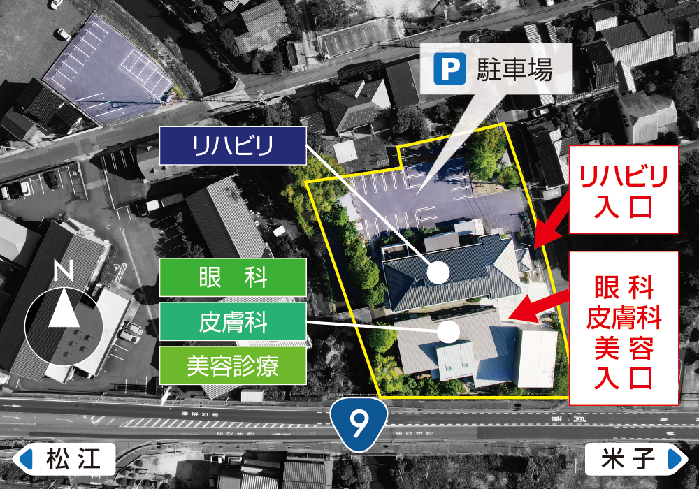 After image